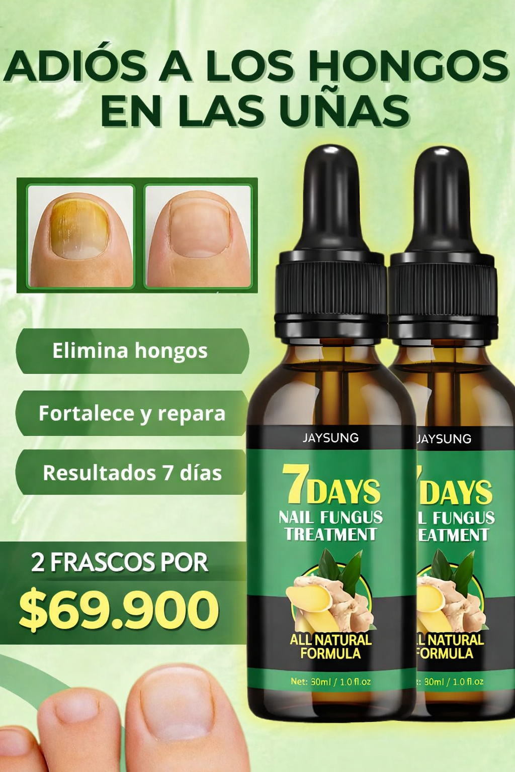 OFERTA 2X1! Serum Reparador: ¡Elimina los hongos y recupera uñas perfectas en solo 7 días!