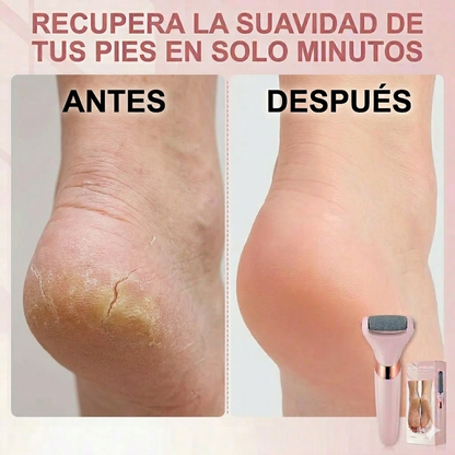 Removedor de Callos Flawless Pedi®: Recupera la suavidad de tus pies en solo minutos
